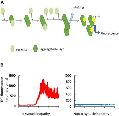 Development of α-Synuclein Real-Time Quaking-Induced Conversion as a Diagnostic Method for α-Synucleinopathies